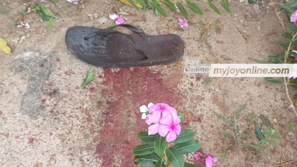 Man cuts off friend’s hand at Millennium City in Gomoa East