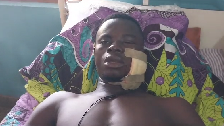 Yeji armed robbery leaves one in critical condition